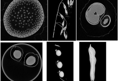 ct scans